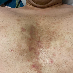 2. Jeg hadde dusjet hver dag i førti år og egentlig aldri blitt ren