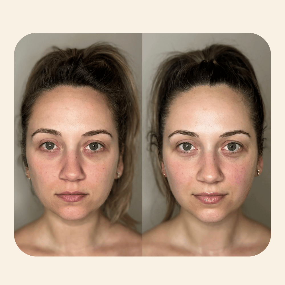 Ansiktsformingsverktøy med rødt lys 2.0