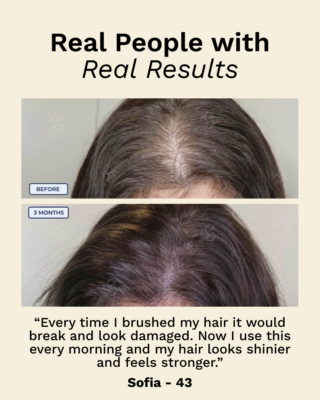 Hår- og hodebunns-massasje-apparat med rødt lys 