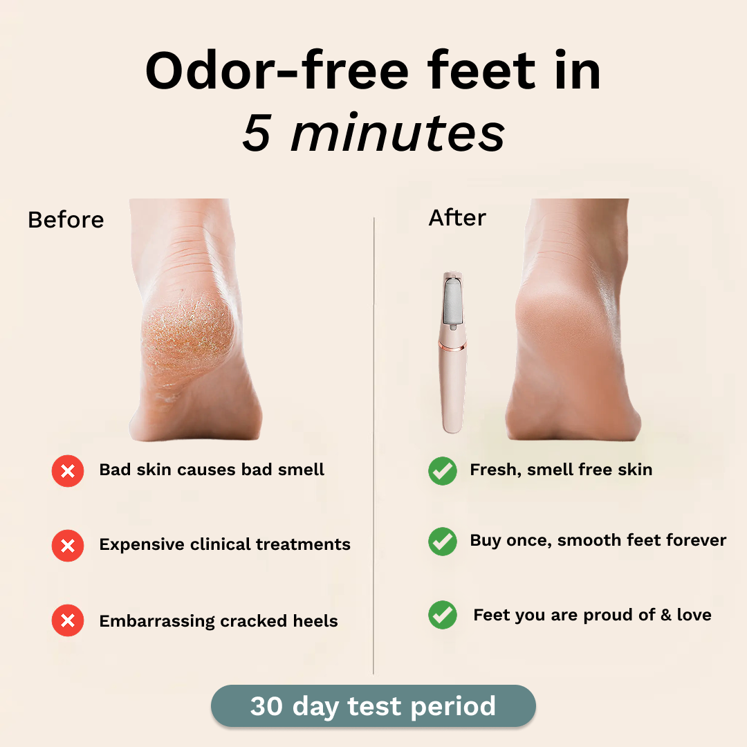 C'est elektrisk fotcallusfjerner PRO