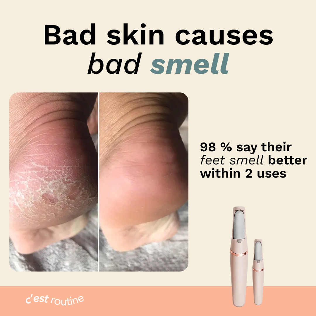 C'est elektrisk fotcallusfjerner PRO