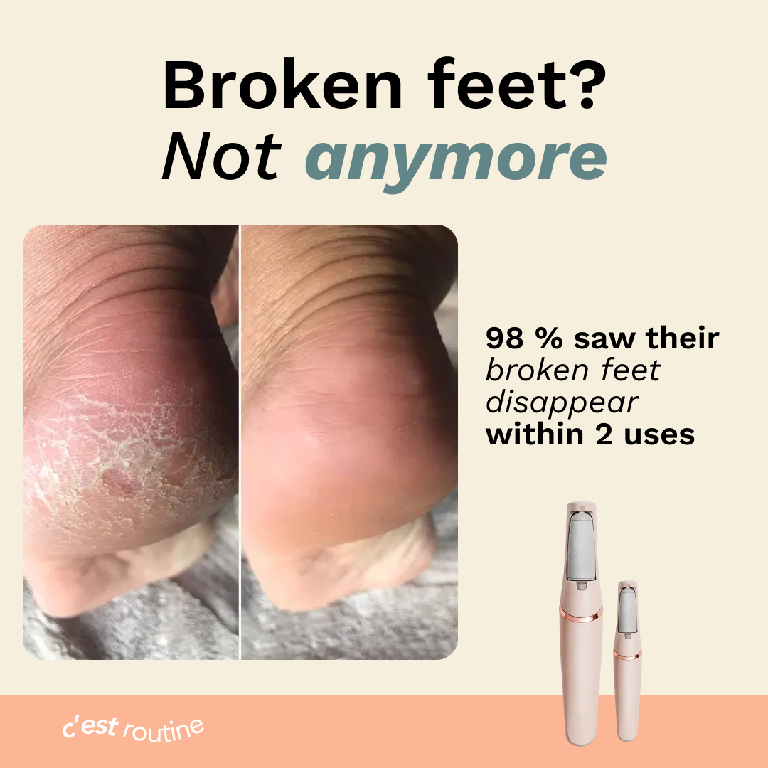 C'est elektrisk fotcallusfjerner PRO