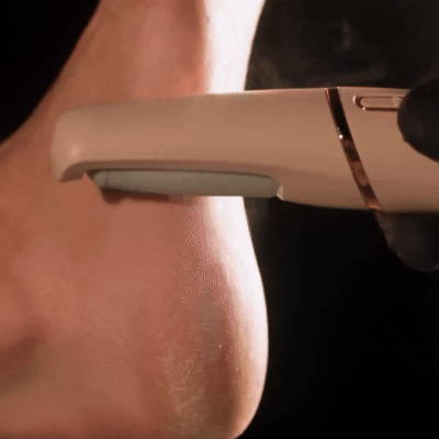 C'est elektrisk fotcallusfjerner PRO