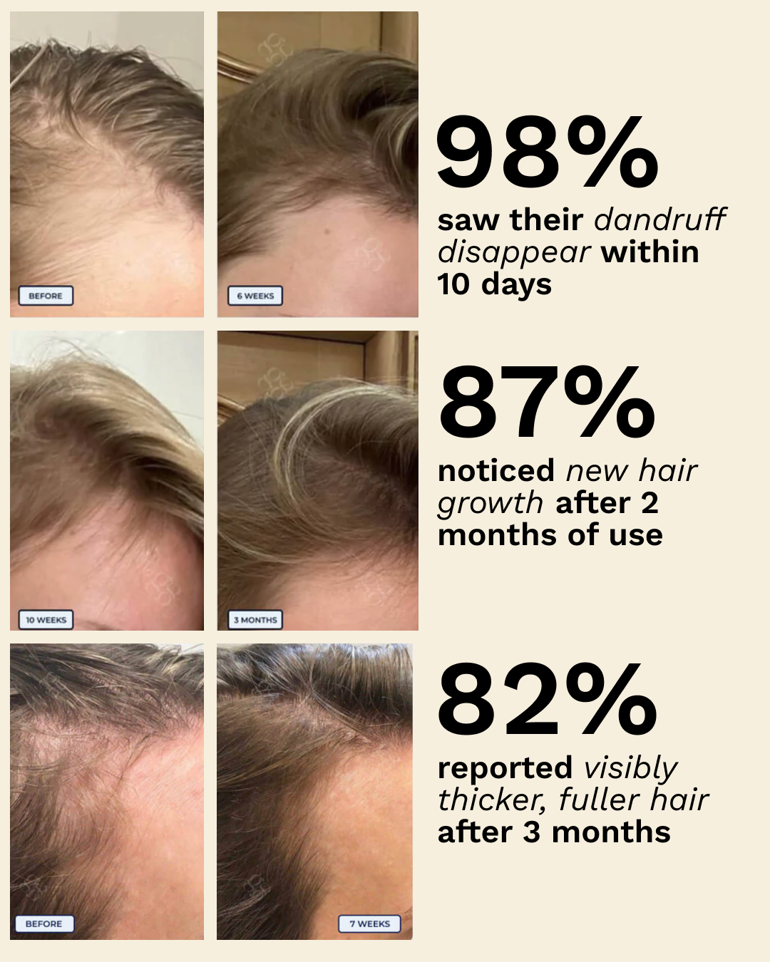 Hår- og hodebunns-massasje-apparat med rødt lys 
